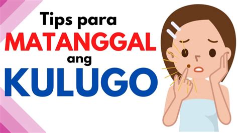 uri ng kulugo|Gamot Sa Kulugo: Paggamot Na Maaaring Gawin Sa Bahay.